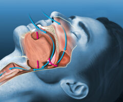 Medically,3d,illustration,shows,a,sleeping,snoring,man